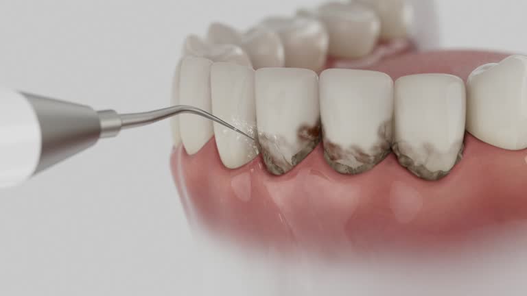 Reliable Dental Implants contractor in St. Charles, MN by Smile Center Dentistry
